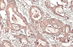 Anti-MMP7 antibody [C2C3], C-term used in IHC (Paraffin sections) (IHC-P). GTX104658