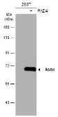 Anti-PAD4 antibody [N1], N-term used in Western Blot (WB). GTX104659