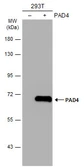 Anti-PAD4 antibody [N1], N-term used in Western Blot (WB). GTX104659