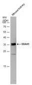 Anti-DDAH1 antibody [C2C3], C-term used in Western Blot (WB). GTX104660