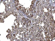 Anti-AICDA antibody [N1N2], N-term used in IHC (Paraffin sections) (IHC-P). GTX104662