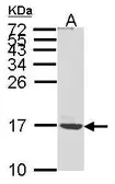 Anti-ATP5G1 antibody [N1C1] used in Western Blot (WB). GTX104671