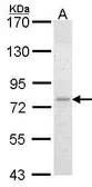 Anti-Frizzled 8 antibody used in Western Blot (WB). GTX104679