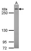 Anti-NOTCH3 antibody [C3], C-term used in Western Blot (WB). GTX104681