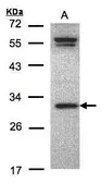 Anti-ORC6 antibody [C2C3], C-term used in Western Blot (WB). GTX104685