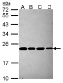 Anti-PSMB5 antibody [C2C3], C-term used in Western Blot (WB). GTX104687