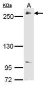 Anti-RPB1 antibody [C3], C-term used in Western Blot (WB). GTX104690