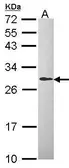 Anti-DCXR antibody [C2C3], C-term used in Western Blot (WB). GTX104696