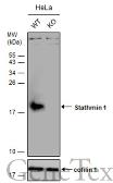 Anti-Stathmin 1 antibody used in Western Blot (WB). GTX104707