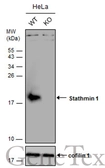 Anti-Stathmin 1 antibody used in Western Blot (WB). GTX104707