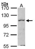 Anti-MAP4K1 antibody [N1], N-term used in Western Blot (WB). GTX104708