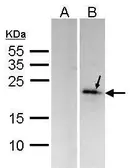Anti-DUSP14 antibody [C2C3], C-term used in Western Blot (WB). GTX104711