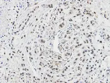 Anti-CacyBP antibody [C2C3], C-term used in IHC (Paraffin sections) (IHC-P). GTX104716