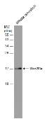 Anti-UBE2L3 antibody used in Western Blot (WB). GTX104717