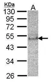 Anti-SOCS4 antibody [C3], C-term used in Western Blot (WB). GTX104721