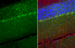 Anti-TRPC6 antibody [C3], C-term used in IHC (Paraffin sections) (IHC-P). GTX104730