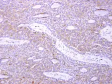 Anti-p41-ARCb antibody [N1], N-term used in IHC (Paraffin sections) (IHC-P). GTX104742