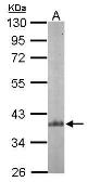 Anti-p41-ARCb antibody [N1], N-term used in Western Blot (WB). GTX104742