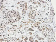 Anti-ARPC1A antibody [N1], N-term used in IHC (Paraffin sections) (IHC-P). GTX104743