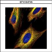 Anti-VDAC2 antibody [C2C3], C-term used in Immunocytochemistry/ Immunofluorescence (ICC/IF). GTX104745