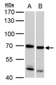 Anti-SSX2IP antibody [C3], C-term used in Western Blot (WB). GTX104750