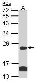 Anti-Claudin 14 antibody [C2C3], C-term used in Western Blot (WB). GTX104751