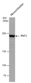 Anti-PATJ antibody [N1], N-term used in Western Blot (WB). GTX104753