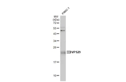 Anti-VPS29 antibody [C1C3] used in Western Blot (WB). GTX104768