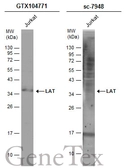 Anti-LAT antibody used in Western Blot (WB). GTX104771