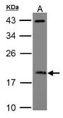 Anti-ARF3 antibody used in Western Blot (WB). GTX104782