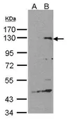 Anti-SIPA1 antibody [C3], C-term used in Western Blot (WB). GTX104786