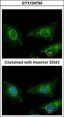 Anti-Asporin antibody [N3C1], Internal used in Immunocytochemistry/ Immunofluorescence (ICC/IF). GTX104790