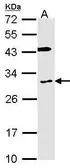 Anti-Cytochrome b reductase 1 antibody [C2C3], C-term used in Western Blot (WB). GTX104793
