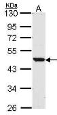 Anti-LXR beta antibody [N1], N-term used in Western Blot (WB). GTX104800