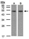 Anti-ATF7 antibody [C3], C-term used in Western Blot (WB). GTX104817