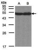Anti-CREB3L1 antibody [C3], C-term used in Western Blot (WB). GTX104818