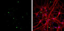 Anti-OLIG1 antibody [C2C3], C-term used in Immunocytochemistry/ Immunofluorescence (ICC/IF). GTX104823