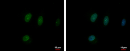 Anti-TFEC antibody [N1], N-term used in Immunocytochemistry/ Immunofluorescence (ICC/IF). GTX104824