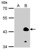 Anti-KLF1 antibody [N1], N-term used in Western Blot (WB). GTX104833