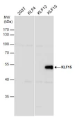 Anti-KLF15 antibody [N1], N-term used in Western Blot (WB). GTX104839