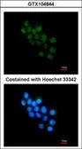 Anti-FOXB1 antibody [C2C3], C-term used in Immunocytochemistry/ Immunofluorescence (ICC/IF). GTX104844