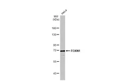 Anti-FOXN1 antibody [C3], C-term used in Western Blot (WB). GTX104849