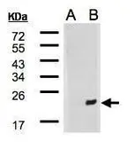 Anti-DNAJB9 antibody [C2C3], C-term used in Western Blot (WB). GTX104853