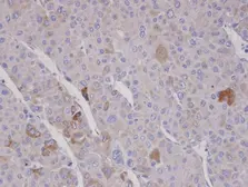 Anti-FBXO2 antibody [C2C3], C-term used in IHC (Paraffin sections) (IHC-P). GTX104858