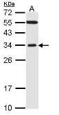 Anti-FBXO2 antibody [C2C3], C-term used in Western Blot (WB). GTX104858