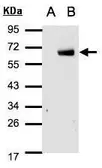 Anti-IRF6 antibody [C3], C-term used in Western Blot (WB). GTX104862