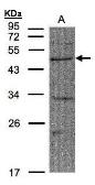 Anti-FBXW2 antibody used in Western Blot (WB). GTX104863