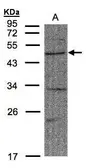Anti-FBXW2 antibody used in Western Blot (WB). GTX104863