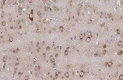 Anti-FBXL2 antibody [N1], N-term used in IHC (Paraffin sections) (IHC-P). GTX104864