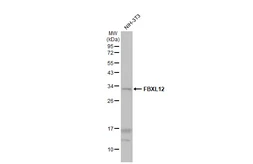 Anti-FBXL12 antibody [C2C3], C-term used in Western Blot (WB). GTX104870
